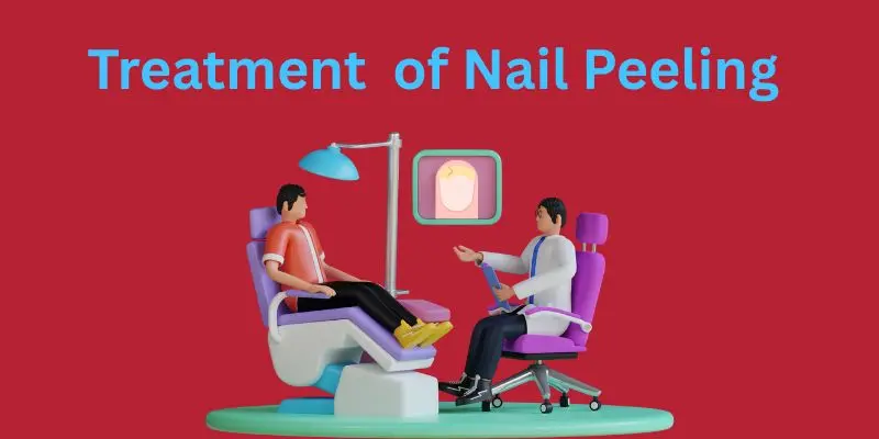 101 Treatment of nail peeling