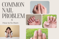 Common Nail Problems and How to Fix Them