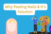 Why Do My Nails Keep Peeling and How to Stop It? - Post Thumbnail