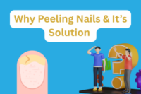 Why Do My Nails Keep Peeling and How to Stop It?