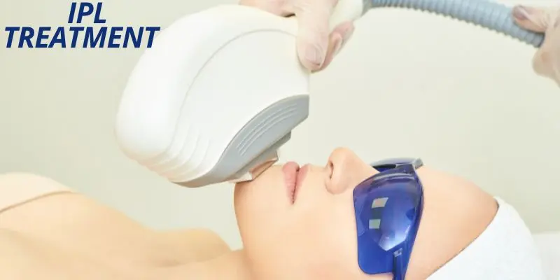 Ipl A women doing ipl treatment